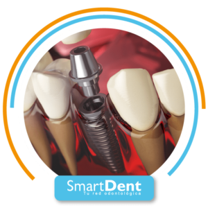 PACK RADIOGRAFÍA FULL IMPLANTES